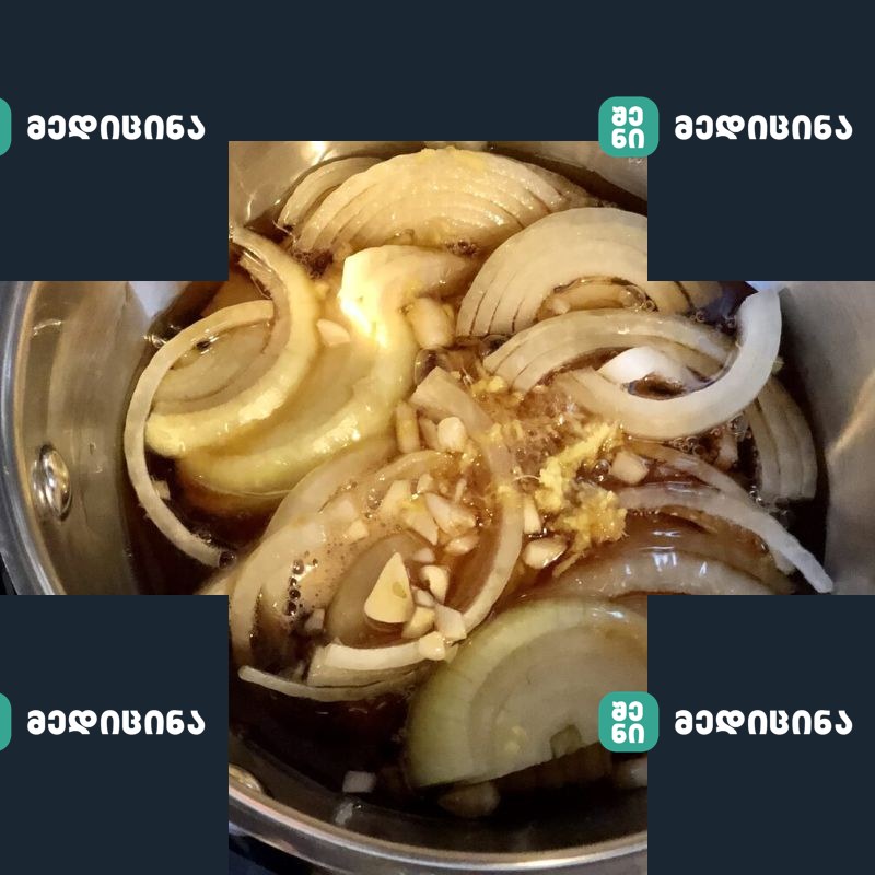 xaxvi da janjafili