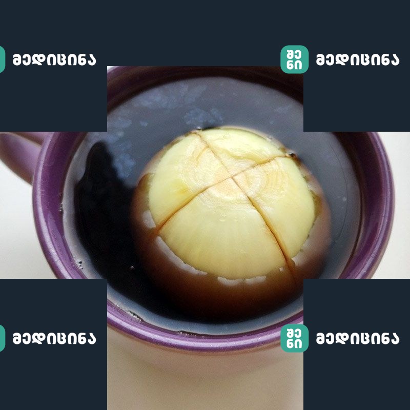 xaxvis chai 1