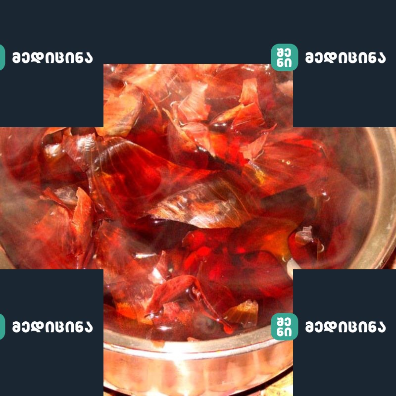 xaxvis furclebis