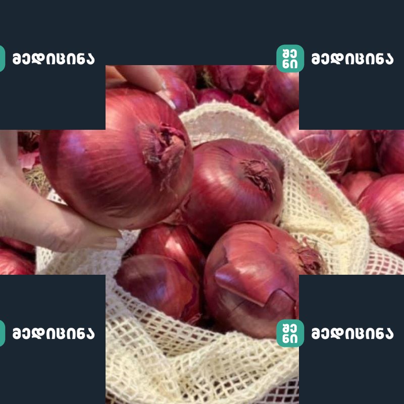 xaxvis sasargeblo tvisebebi