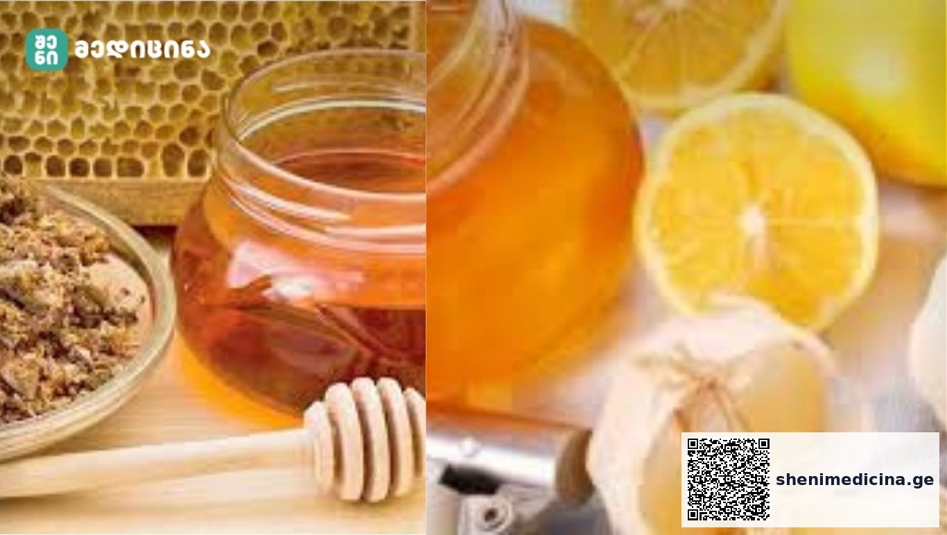🧄🩸 როგორ გავიწმინდოთ სისხლძარღვები ბუნებრივი საშუალებებით - 5 რეცეპტი